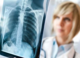 Tüdőszűrés lesz Röszkén