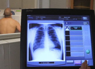 Tüdőszűrés Sándorfalván